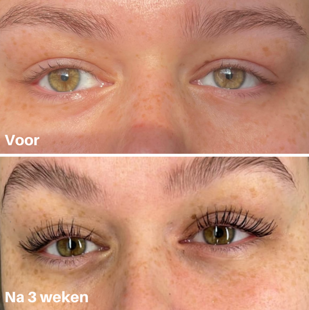 Lash Éternel™ – Klinisch Ondersteund Wimperserum